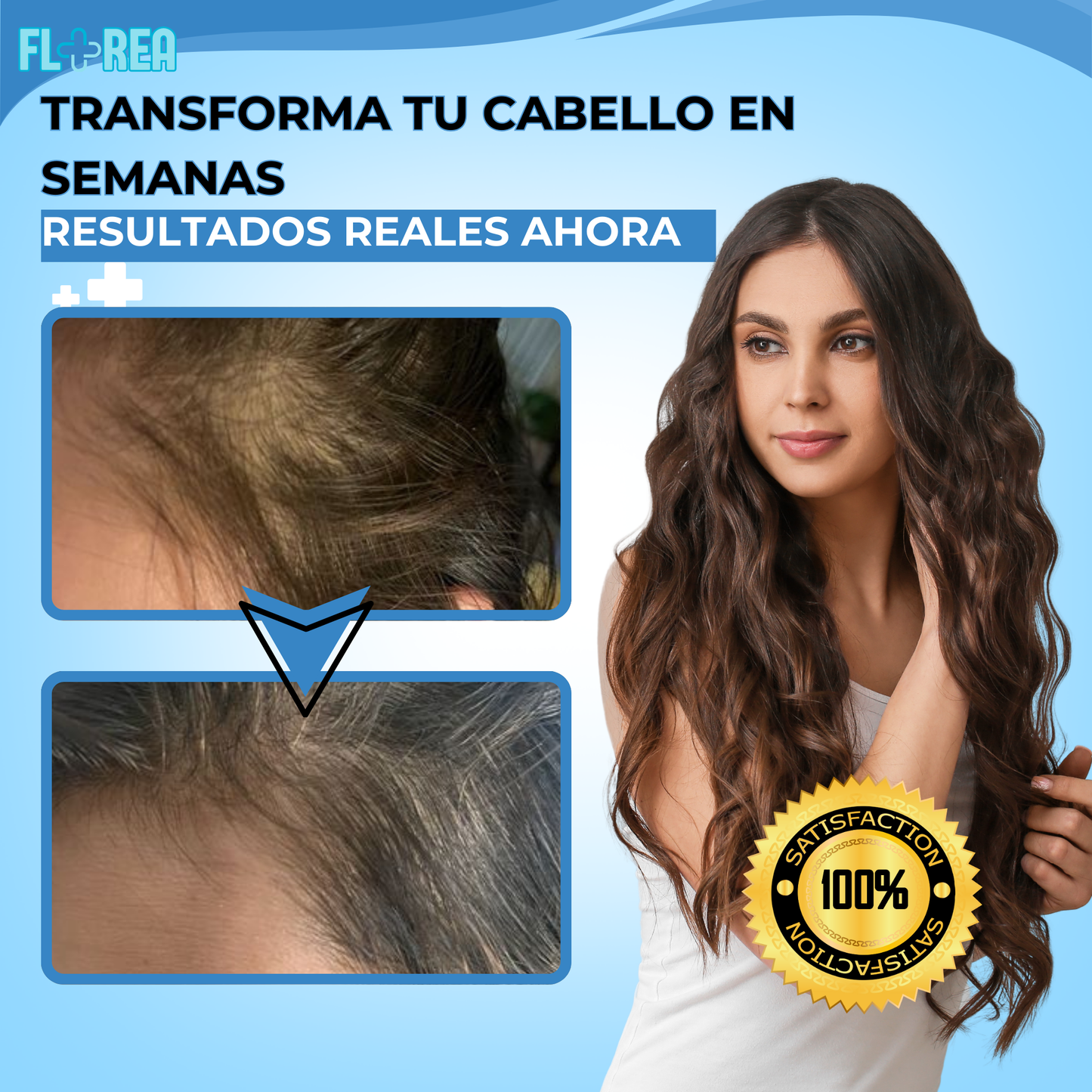 1+1 GRATIS - CAPILUXE™ | RECUPERA TU CABELLO MÁS FUERTE Y VOLUMINOSO