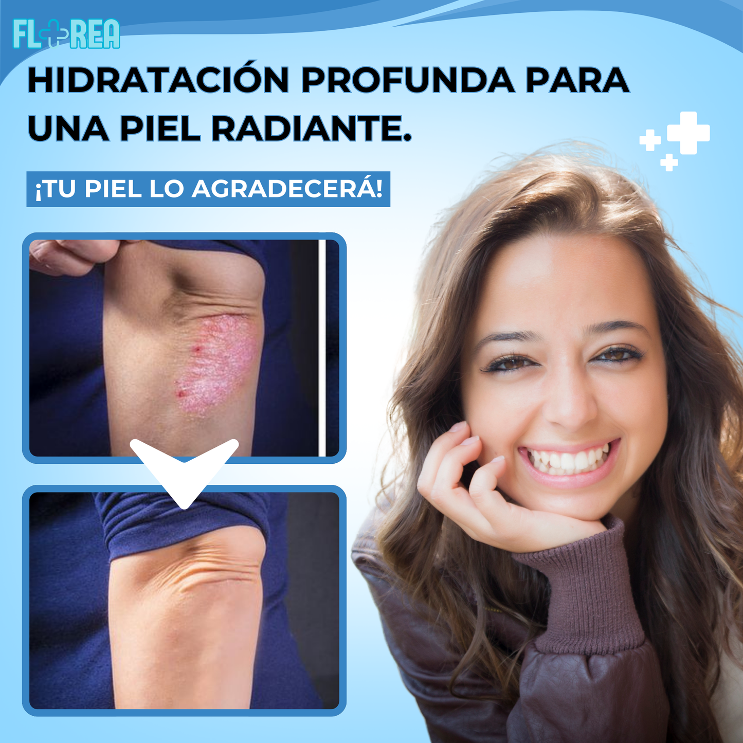 1+1 GRATIS - DIARELIEF™ | CONSIGUE UNA PIEL HIDRATADA Y LIBRE DE ESCEMAS Y ENFERMEDADES