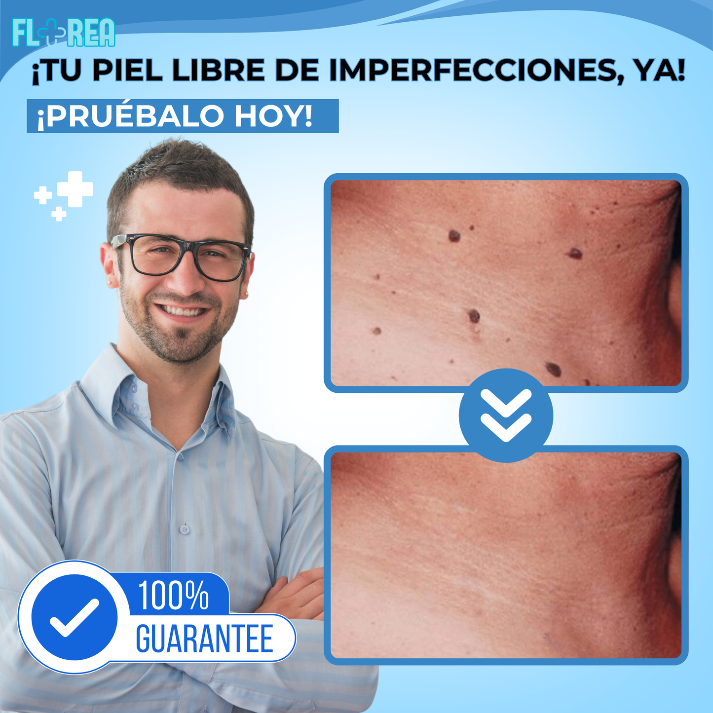 Fivfivgo™ QuitaVerrugas y Lunares WipeOff