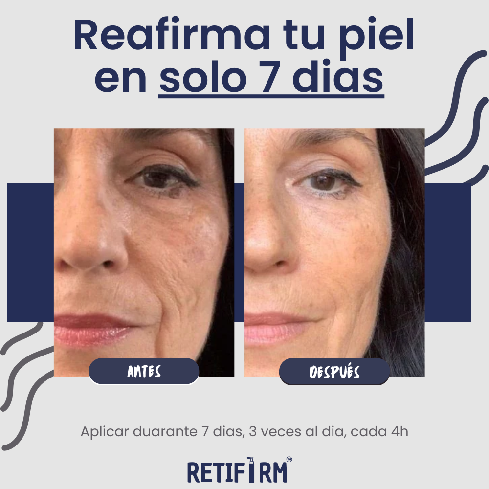 RETIFIRM | DESCUBRE COMO ELIMINAR LOS SIGNOS DE LA EDAD EN TU PIEL (1+1 GRATIS SOLO HOY)